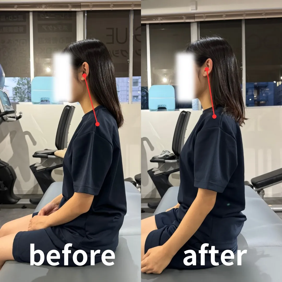 猫背は特別なトレーニングだけでなく、日々のケアで十分改善でき...